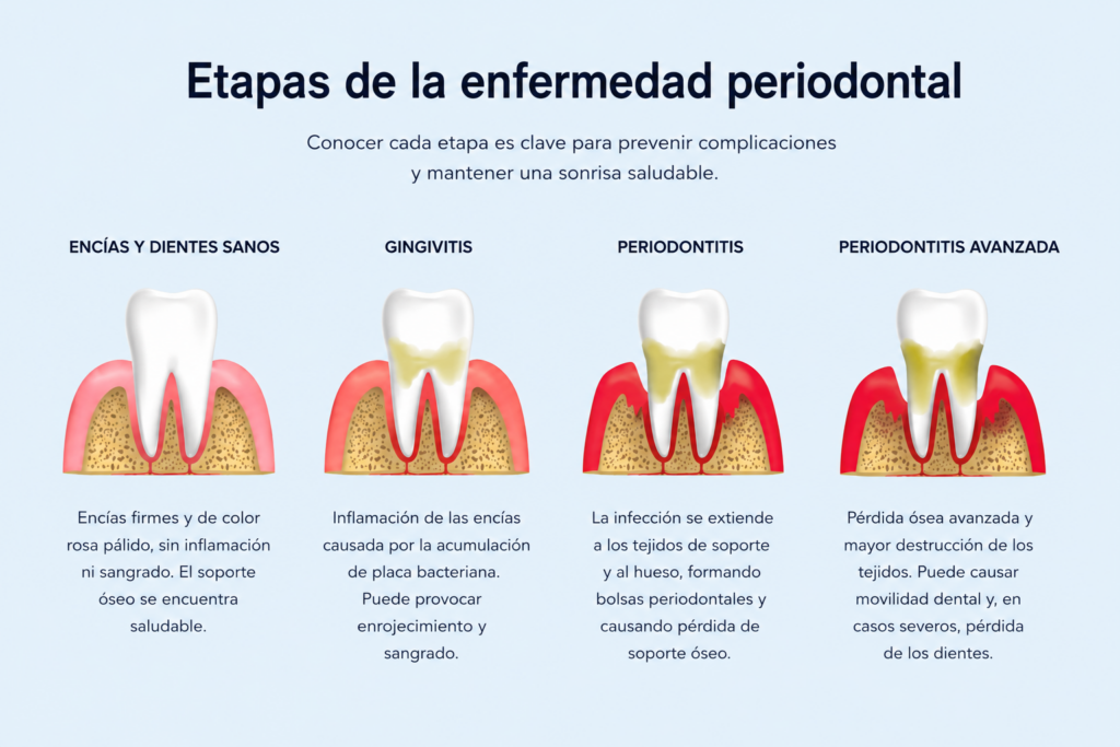 perio